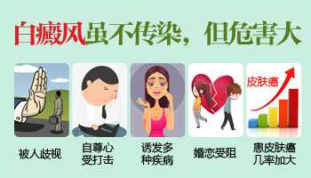 颈部下边长白斑会不会有生命危险