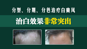 要想治白有效 白白们需这样做