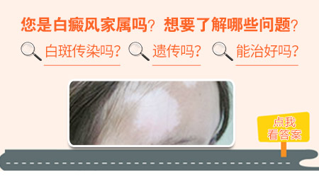 白癜风男女遗传比例是多少