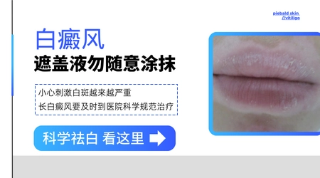 刚发现的白斑用遮盖液有影响吗