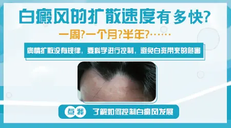 脖子晒伤后白了一小块