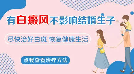 白癜风用药期间能不能怀孕