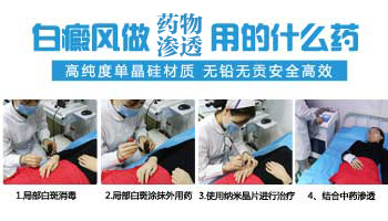 中医治疗白癜风的方法有哪些