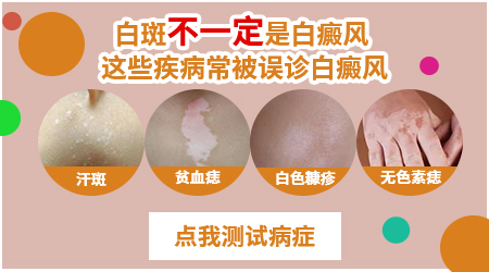 5岁男孩孩子脸上有一块白色斑点