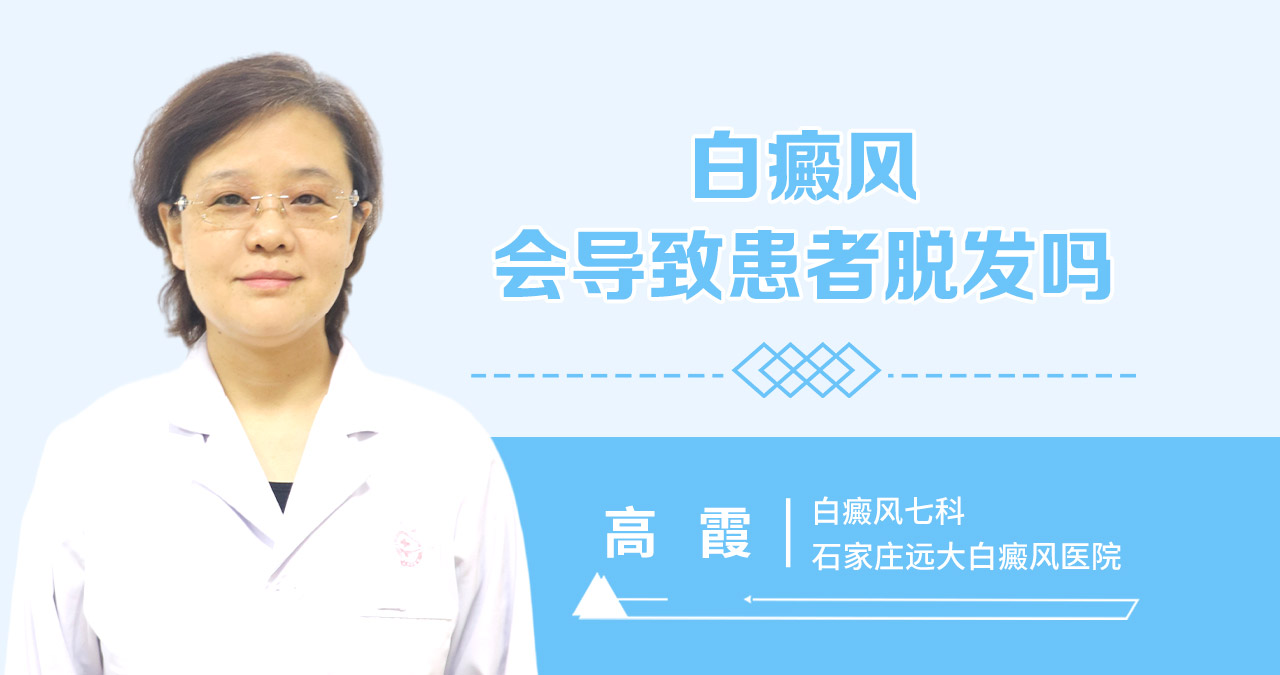 白癜风会导致患者脱发吗