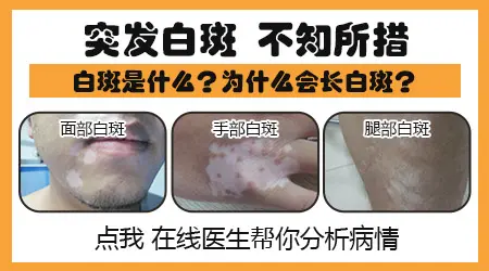 男性生殖部位有白斑怎么回事
