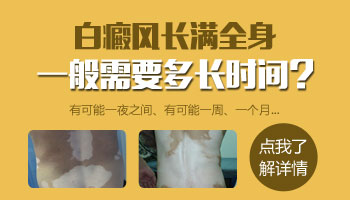 白癜风早期到晚期需要多长时间