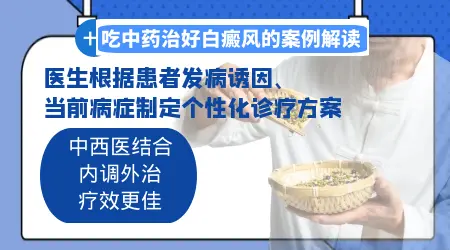 白癜风有没有用中药调理治好的