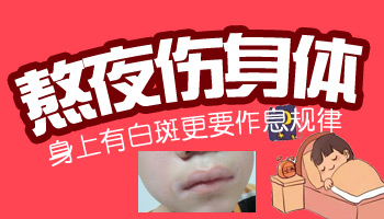 腹股沟出现一块白色是为什么