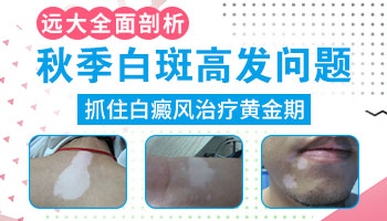 伍德灯检查结果加减符号什么意思