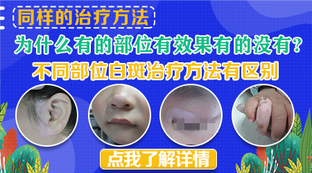 眼睛和鼻梁边缘皮肤有一小部分变白了