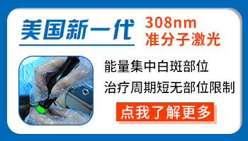 孩子的臀部有一大块白斑好几个月了怎么治