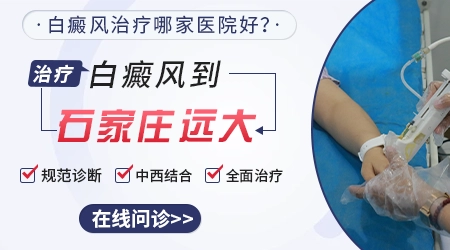 石家庄看白癜风应该去哪个医院