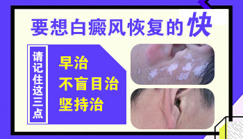 白癜风激光内缩多久能恢复