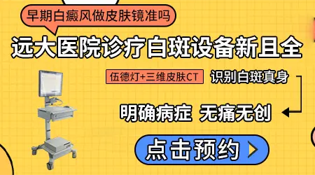 皮肤镜能查出刚长的早期白癜风吗