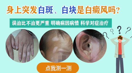 孩子头上有一块白斑是怎么回事