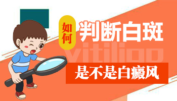 白斑是白癜风吗 怎么准确判断