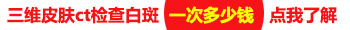 胸前有一些白斑害怕是白癜风需要做哪些检查