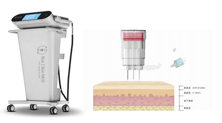 白癜风纳米促黑是什么方法