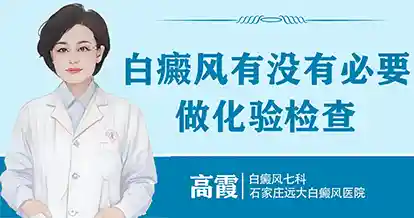 白癜风有没有必要做化验检查