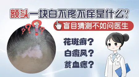 额头上长白块是什么原因造成的