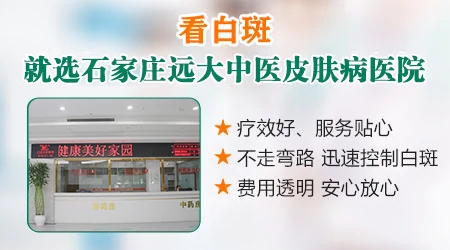 石家庄本地治白斑的专科医院哪里好