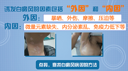 臀部皮肤为什么有很多白点