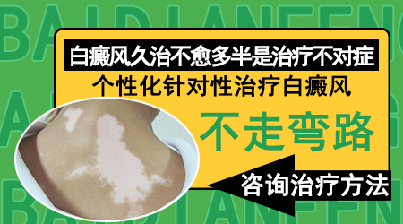 白癜风是不能治愈的吗
