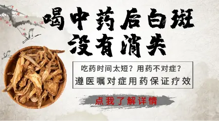 白癜风吃中药3个月没见效是不是方法无效