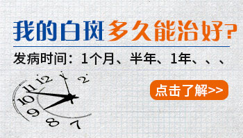 窄谱紫外线照白癜风多久出效果