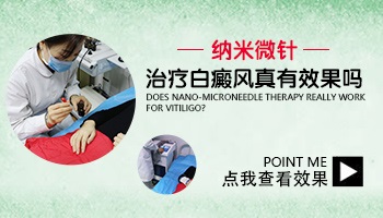 白斑做纳米微针效果怎么样