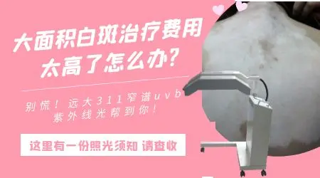 白癜风治疗需要多少钱 大面积白癜风治得好吗