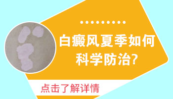 为什么白癜风在治疗期间会扩散