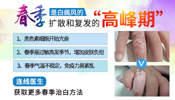 白斑在伍德灯下蓝白色斑片境界清楚是白癜风吗