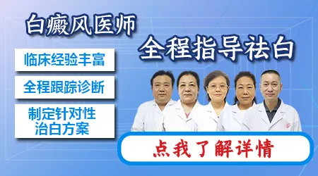 白癜风喝中药期间要不要同时照308nm激光