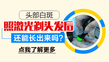 白癜风导致的毛发也变白了还能治疗好