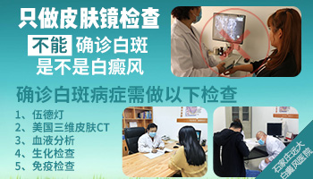 早期白癜风在皮肤镜下什么样