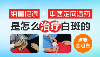 孩子身上多处有白癜风怎么治疗好