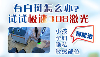 白癜风照308一星期一次和隔天一次效果一样吗