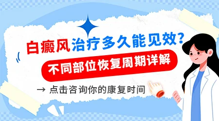 白癜风一般治疗多久能看到明显效果