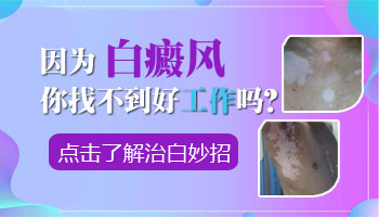 白癜风影响入职体检吗
