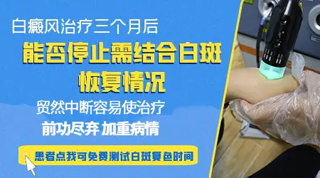 他克莫司治疗白斑多久起效