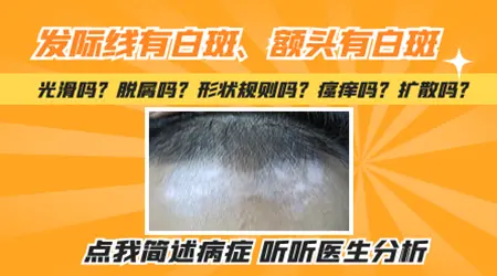 女性发际线边缘发白是怎么了