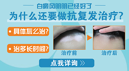 白癜风都要做抗复发治疗吗