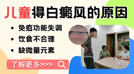 儿童眼周白癜风适合照光吗