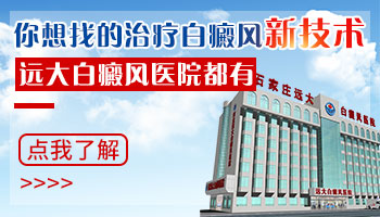 邯郸白癜风医院技术怎么样