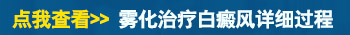 白癜风做雾化一次多少钱