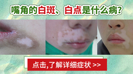嘴角有一小块特别小的白斑是什么
