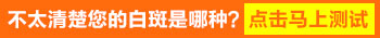 腹股沟有白斑是不是白癜风