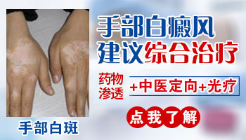 宝宝手部白斑照完308激光的图片